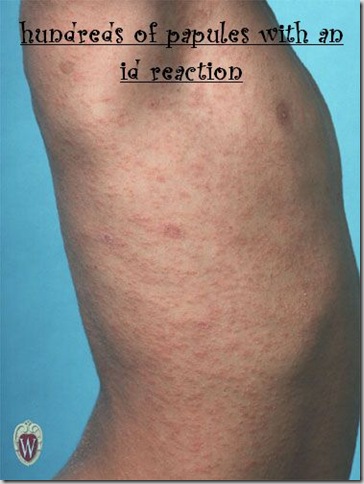 Medicine Decoded: skin lesions